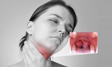 Bademcik Ameliyatı İyileşme Süresi Ne Kadar?